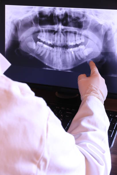 Best Walk-In Emergency Dentist in Gillette, NJ