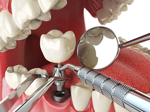 Best Walk-In Emergency Dentist in Gillette, NJ